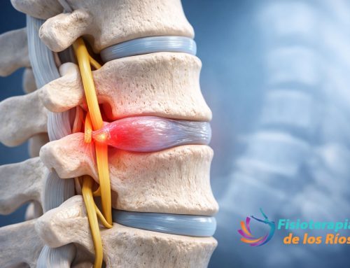 🌟 Protusión discal: causas, síntomas y el tratamiento más eficaz para volver a vivir sin dolor